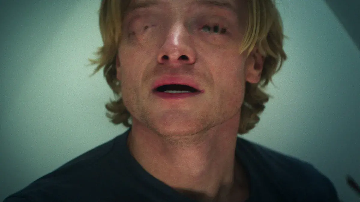 Matt Hagen, joué par Tom Rhys Harries, le visage marqué de cicatrices et les yeux humides, sous une lumière bleue dans Clayface