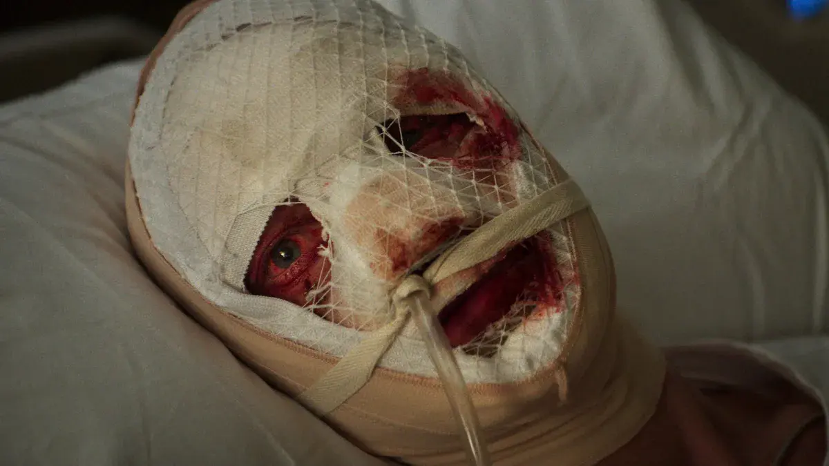 Clayface : Matt Hagen, le visage couvert de bandages ensanglantés, sur un lit d'hôpital